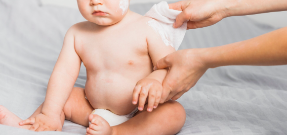 Caring for sensitive baby skin